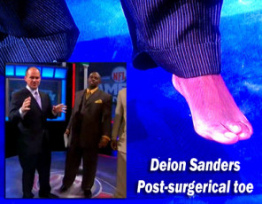 Deion Sanders Feet (4 photos)
