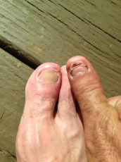 Nelson Bonilla Feet (3 photos)