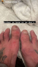 Donald Cerrone Feet (12 photos)