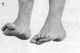 Vittorio Gassman Feet (12 photos)