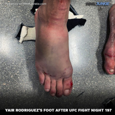 Yair Rodriguez Feet (2 photos)