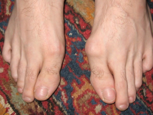 Barrett Long Feet (3 photos)