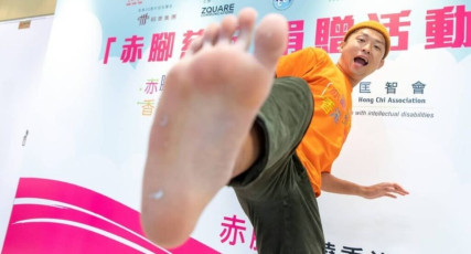 Milkson Siu Chung Fong Feet (2 photos)