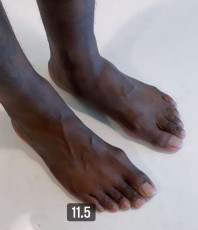 Phor Feet (2 pics)