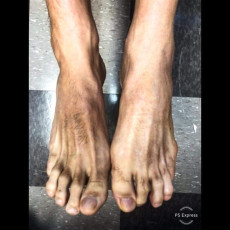 Rib Hillis Feet (7 images)
