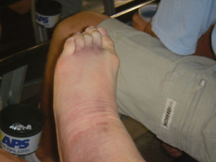 Ricky Carmichael Feet (2 photos)