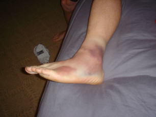 Ricky Carmichael Feet (2 photos)