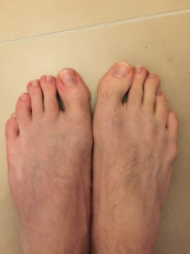 Thom Yorke Feet