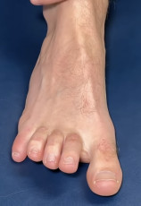 Dr Michael Rowe Feet (146 photos)