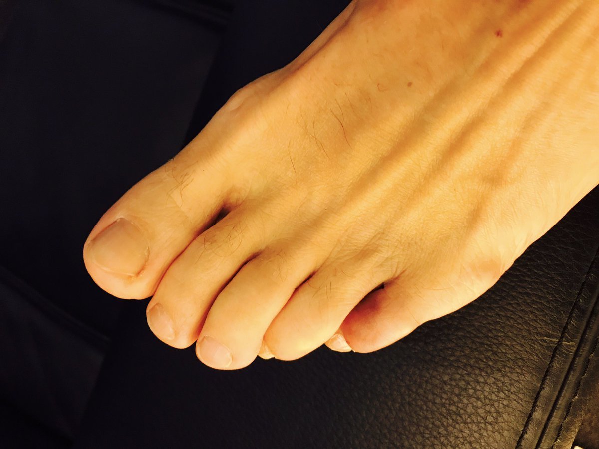 Gary Barlow Feet