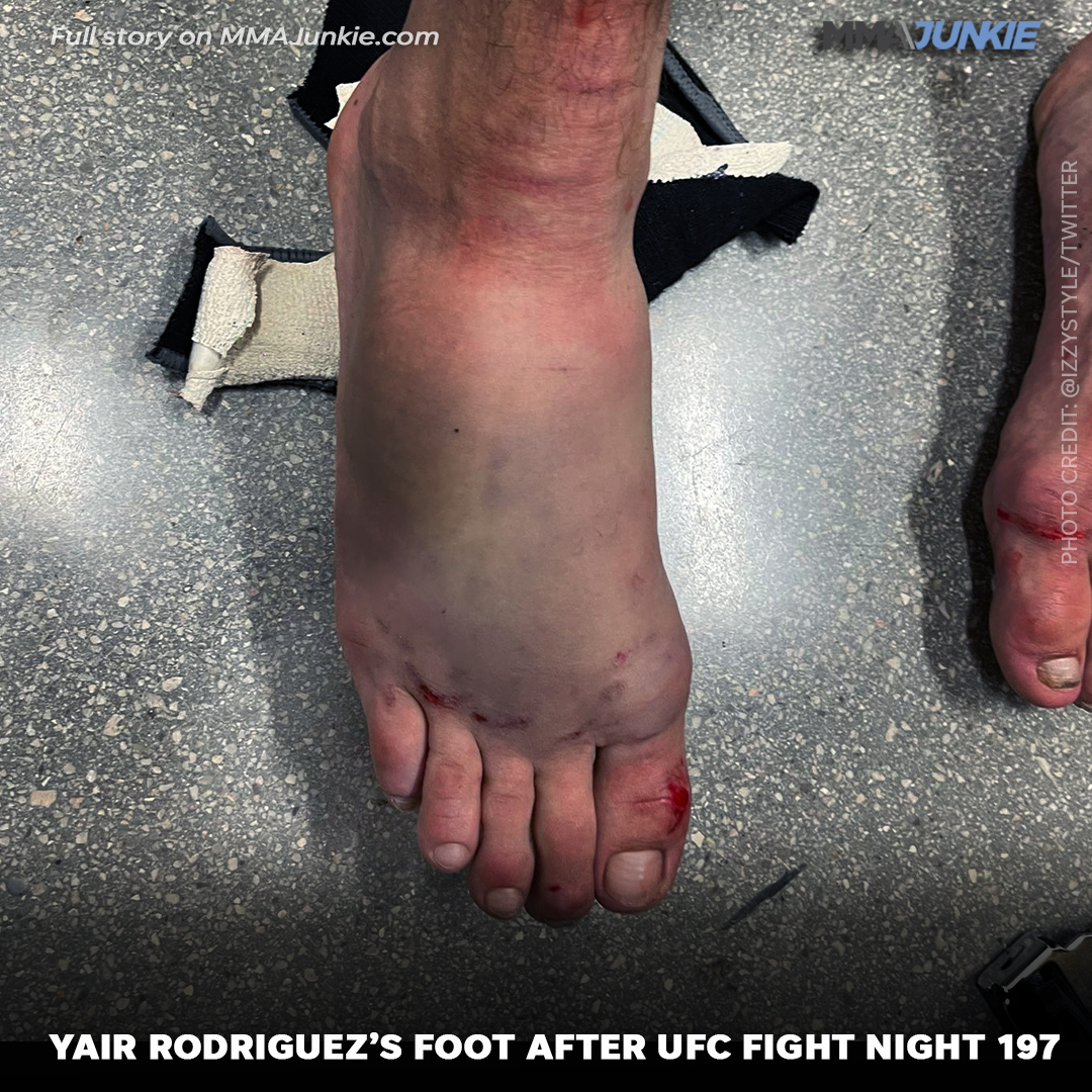 Yair Rodriguez Feet