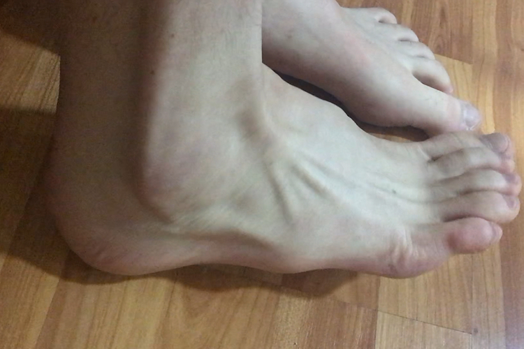 Nikola Scekic Feet