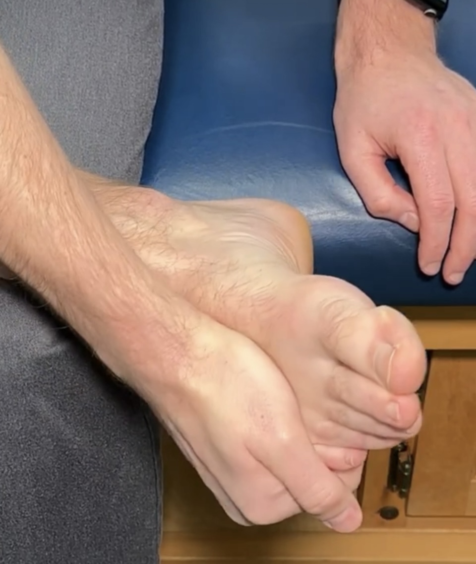 Dr Michael Rowe Feet