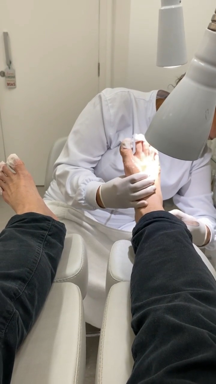 Fabio Villa Verde Feet